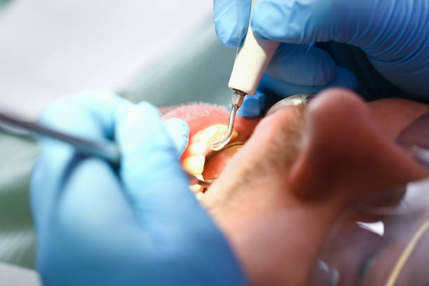 Best Emergency Treatment for Oral Infections in Iowa Colony, TX