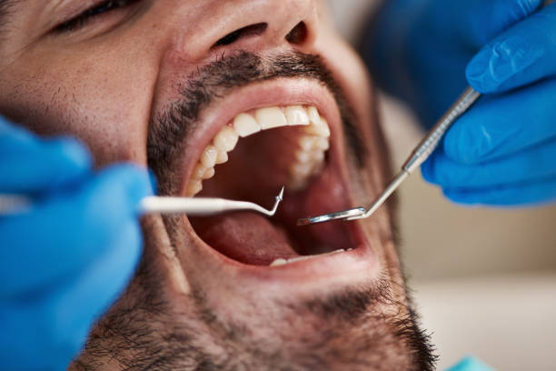 Best Emergency Care for Gum Disease in Iowa Colony, TX